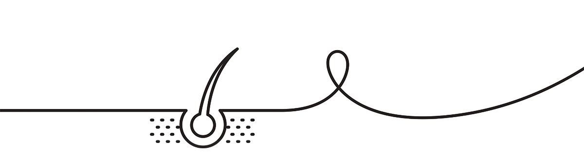 Line drawing of hair being removed by laser